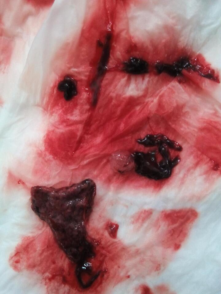 唉 怀个孕还那么担惊受怕
