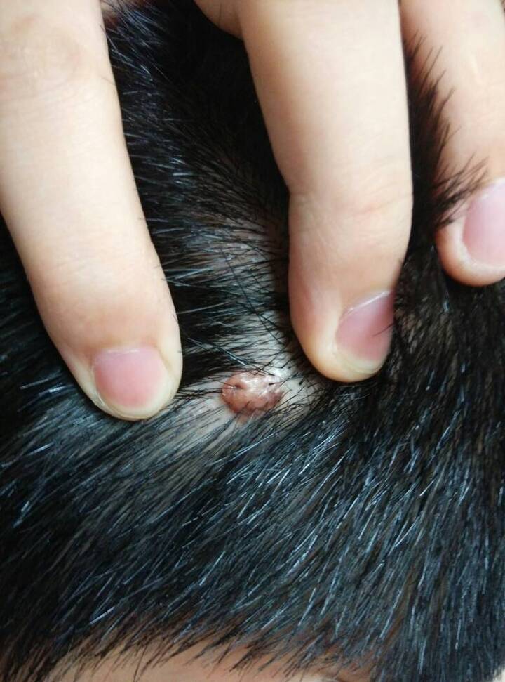 长了个小肉球 手机壁纸 电脑壁纸 桌面壁纸 图客网