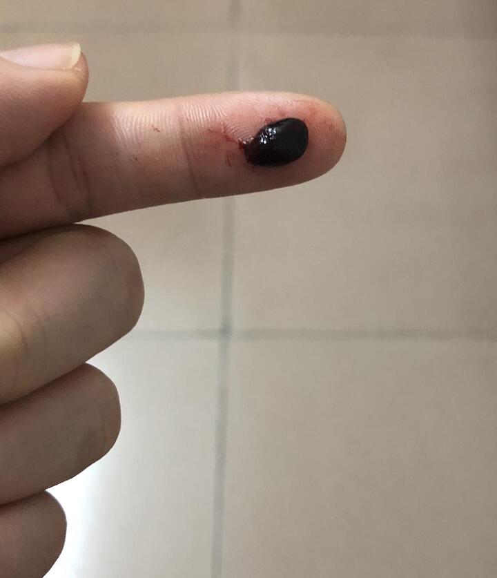 期 出血 排卵