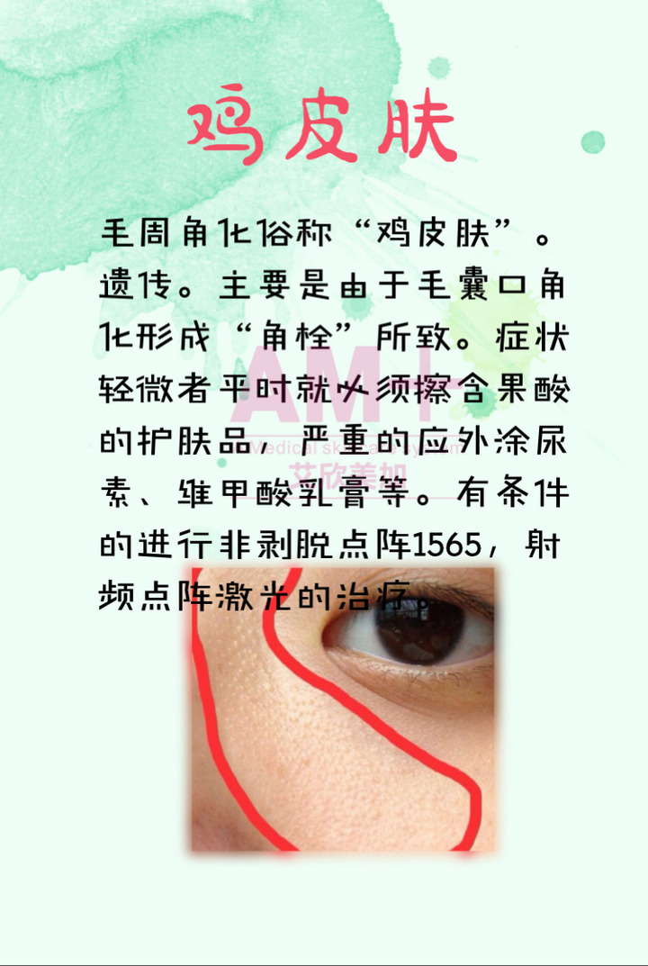 白眼球上有白色凸起物_手机壁纸_电脑壁纸_桌面壁纸