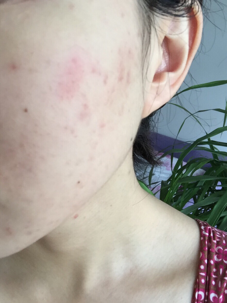 周公解梦,梦见吃大便,寓意何在? 周公解梦,梦见吃大便,寓意何在?